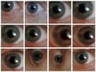 human eye montage